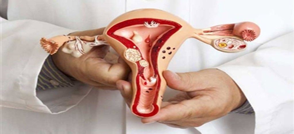 تعداد داروهای مختلف دیگری وجود دارد که میتواند باعث جبران کمبودهای آنزیمی در داخل تخمدان شود