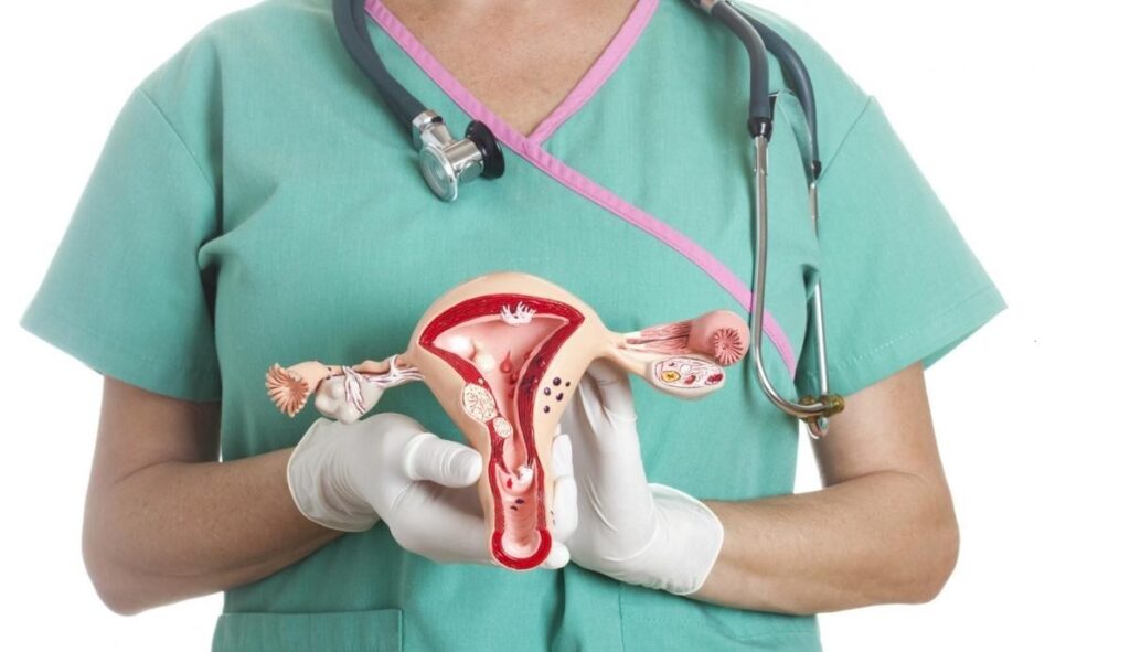 آیا میدانید علائم و نشانههای تنبلی تخمدان چیست؟