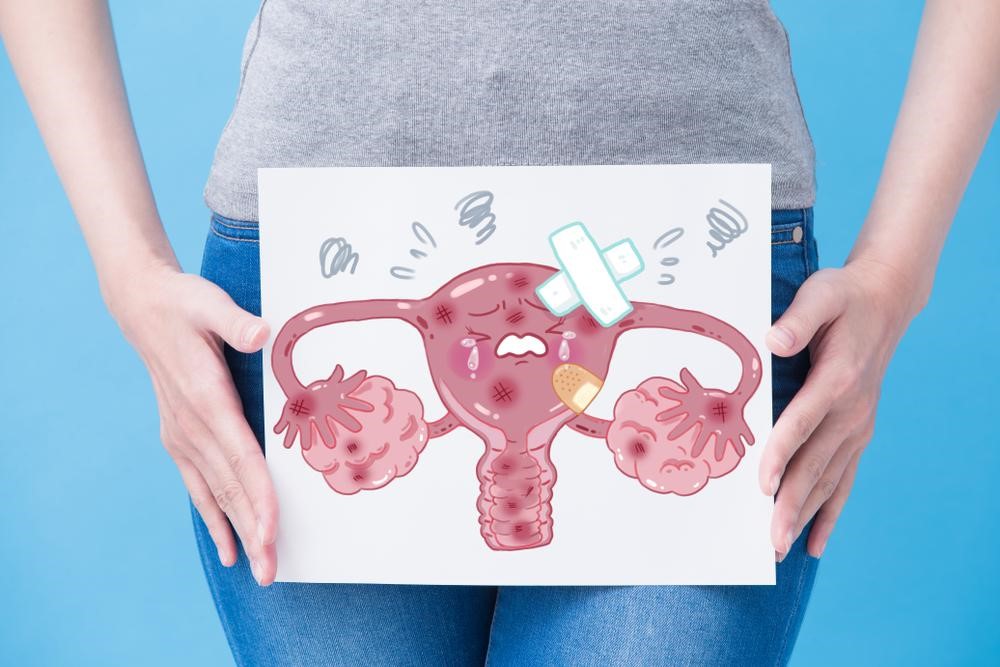 آیا میدانید چه مواردی موجب عدم تخمکگذاری در بدن بانوان میشود؟